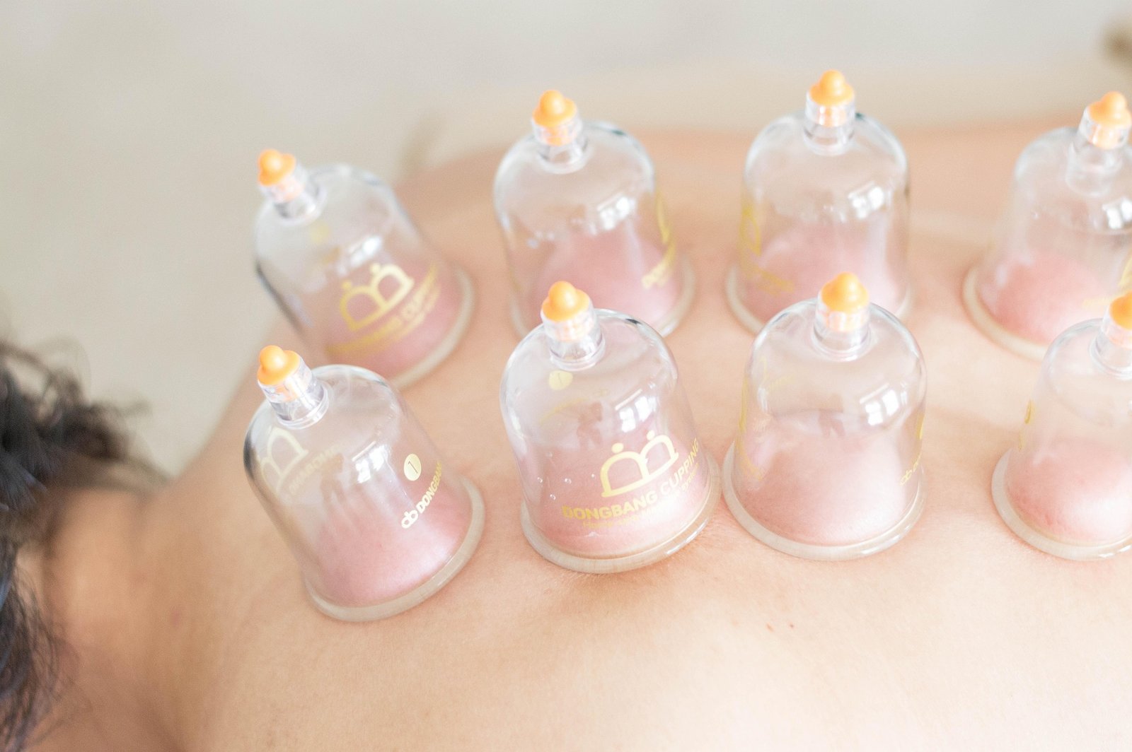 Cupping Massage